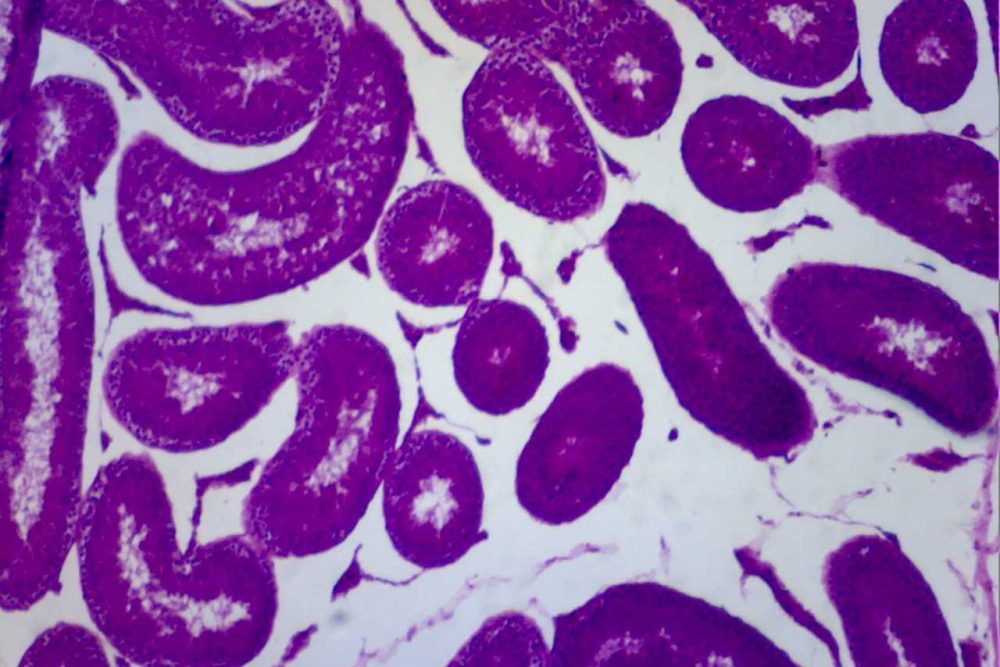 i bibliothiki apektise mikroskopio 2018 11 16 1